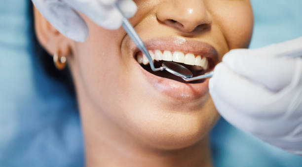 Best Emergency Treatment for Toothache in South Coventry, CT