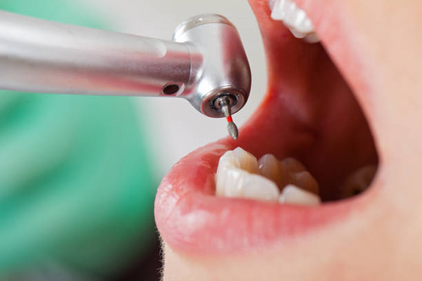 Best After-Hours Emergency Dentist in South Coventry, CT